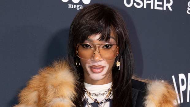Winnie Harlow